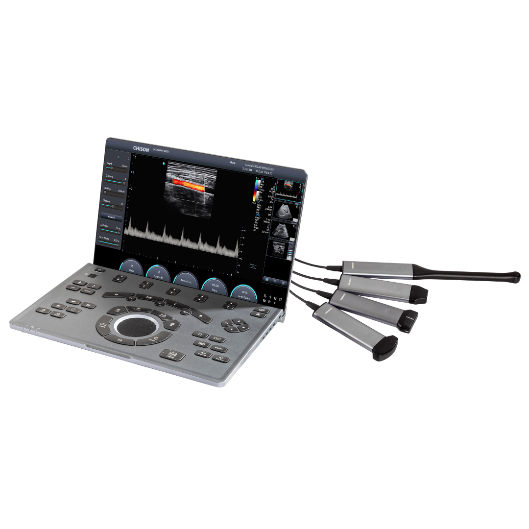 Chison SonoAir 30 Austeller mit Linear- & Convexsonde (inkl. 2 Sonden)